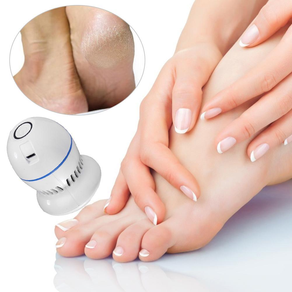 Smart Callus Remover